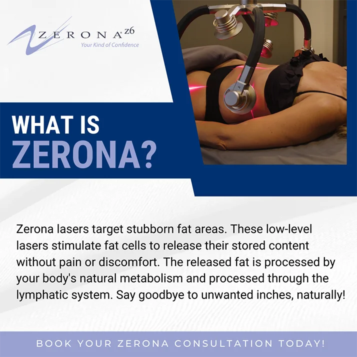 Zerona informational graphic showing low-level laser treatment on a patient's abdomen